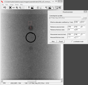 Densitometric measurement of wall thickness in the wtScope software (2002)